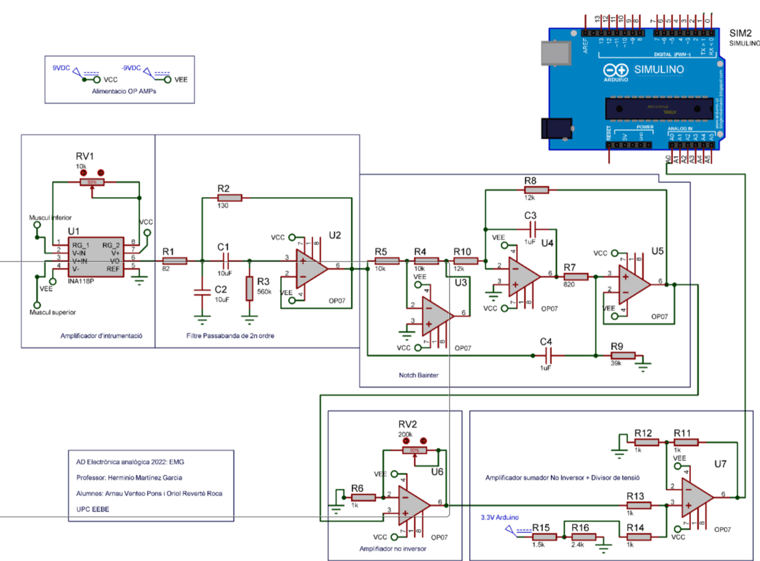University - Electromyography (EMG) - Image 1